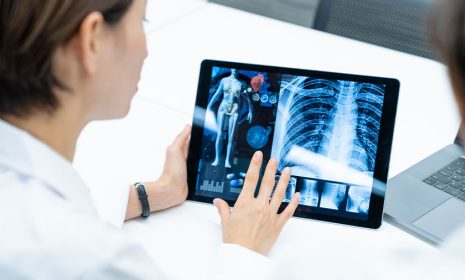 Junge Ärztin hält ein Tablet. Auf dem Tablet sehen wir Röntgenbilder eines Menschen