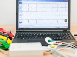 Laptop, auf dessen Screen die Kurven eines EKGs zu sehen sind. Davor liegt ein Gerät für die Erfassung der Werte.
