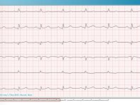 Screen der PADSY-Software Ruhe-EKG Übersicht